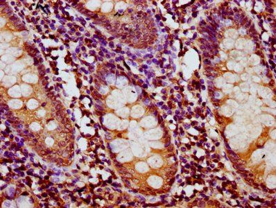 HYI Antibody