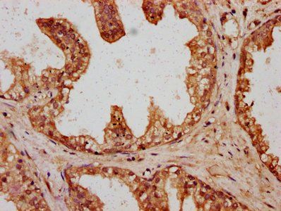 HYI Antibody