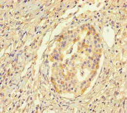 HYPM Antibody