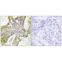 IARS2 antibody