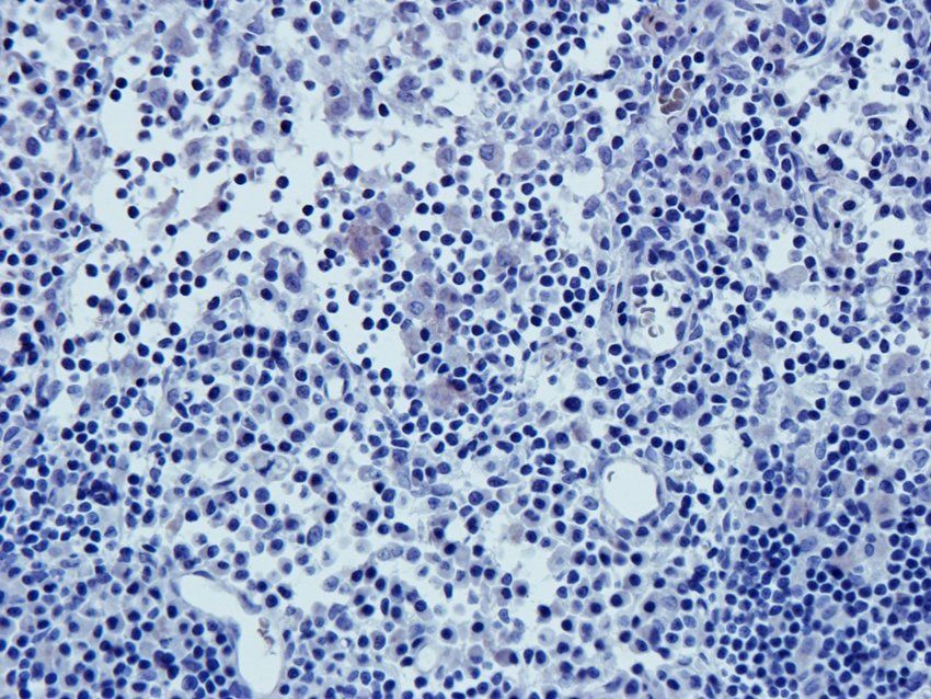 ICAM1 antibody