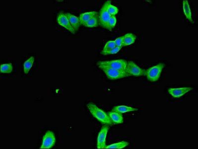 ICAM1 Antibody