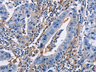 ICAM1 Antibody