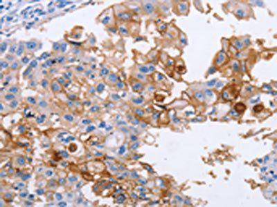 ICAM1 Antibody