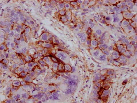 ICAM1 Monoclonal Antibody