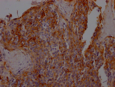 ICAM1 Recombinant Monoclonal Antibody