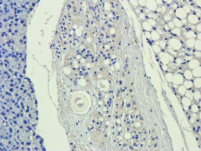 ICAM1 antibody