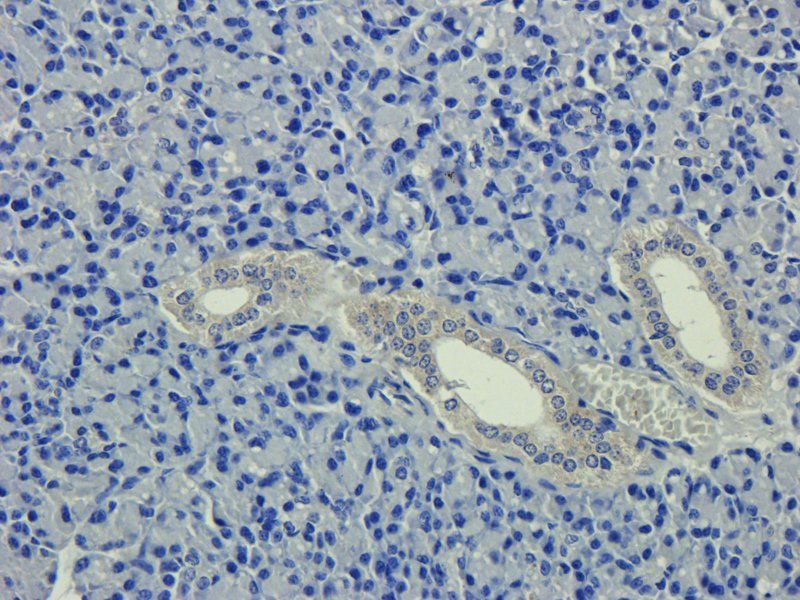 ICAM1 antibody