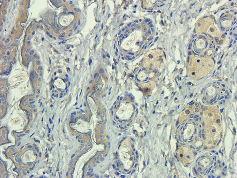 ICAM1 antibody