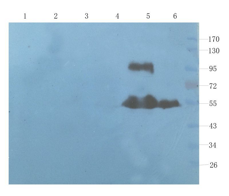 ICAM1 antibody