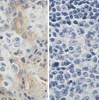Icam1 Rabbit Polyclonal Antibody