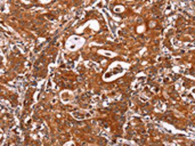 ICAM3 Antibody