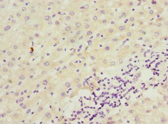 ICAM4 antibody