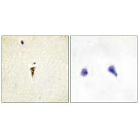 ICK Antibody