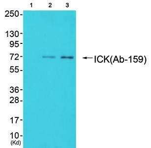 ICK antibody