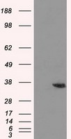 ICOS Antibody