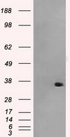 ICOS Antibody