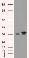 ICOS Antibody