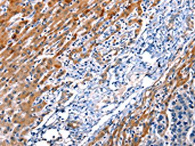 ID4 Antibody