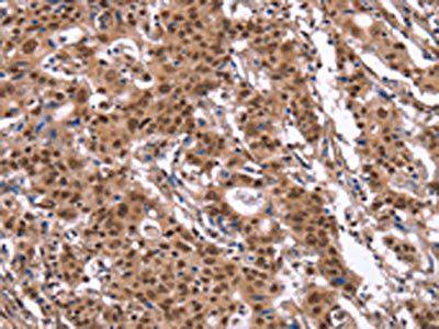 ID4 Antibody