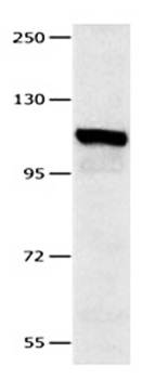 IDE Rabbit Polyclonal Antibody