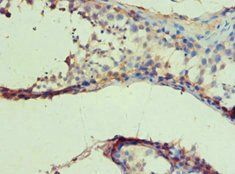 IDH1 Antibody