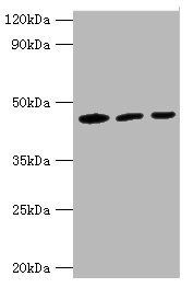 IDH1 Antibody