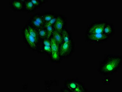 IDH1 Antibody