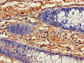 IDH1 Antibody