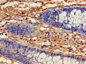 IDH1 antibody