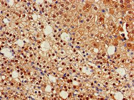 IDH1 Antibody