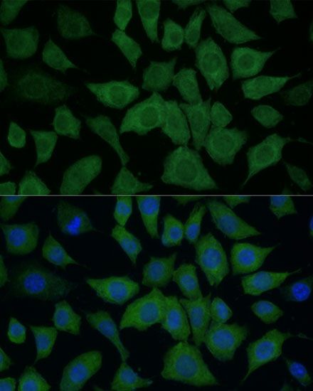 IDH1 antibody