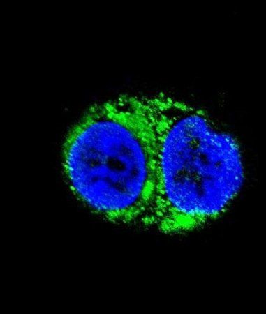 IDH1 antibody