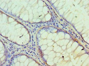 IDH2 antibody