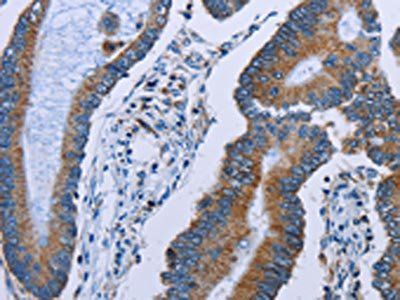 IDH2 Antibody