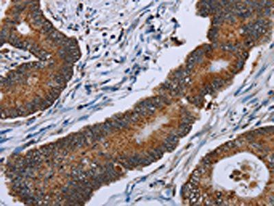 IDH2 Antibody