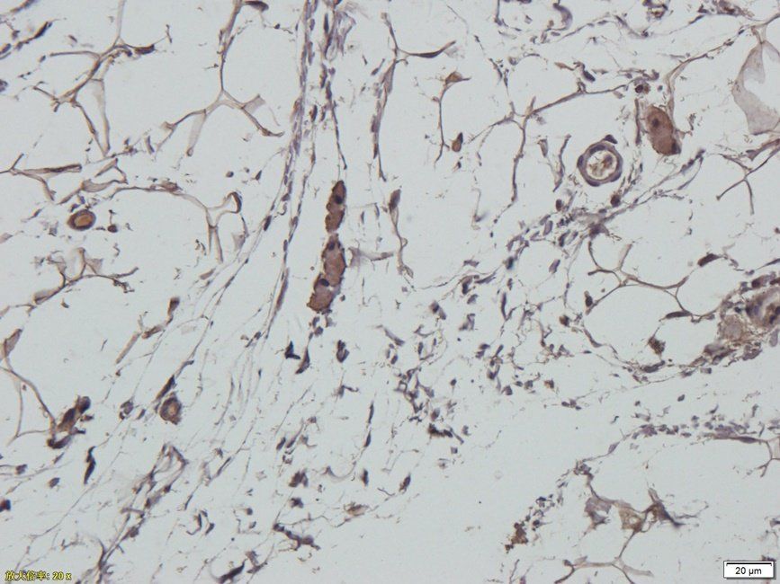 IDH2 antibody