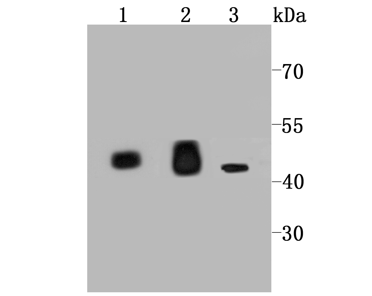 IDH2 Antibody