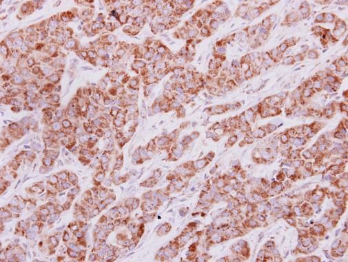HPRT antibody