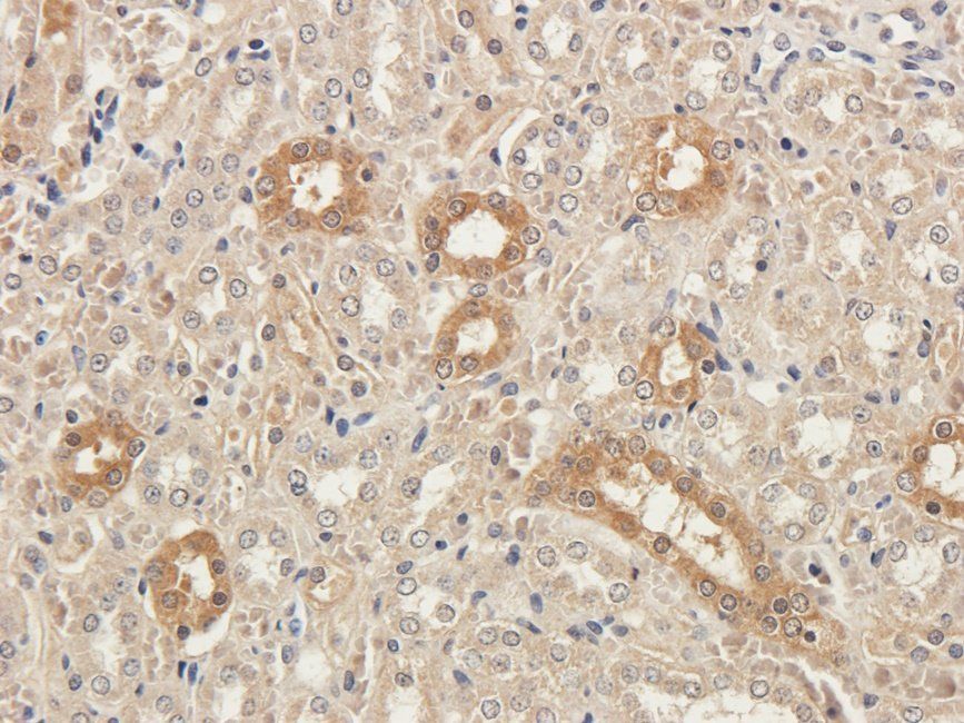 IDHP Rabbit Polyclonal Antibody