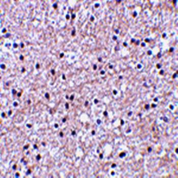 IEX Antibody