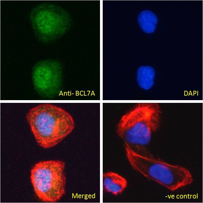 Goat anti-BCL7A Antibody