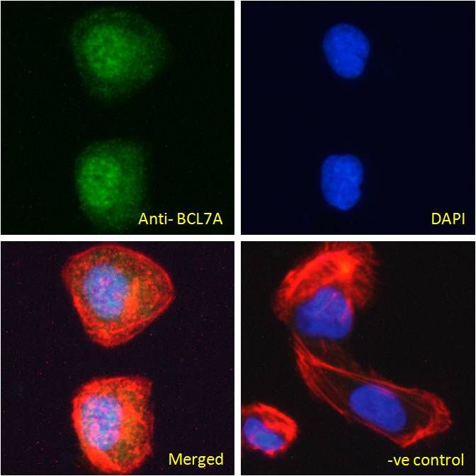 BCL7A antibody