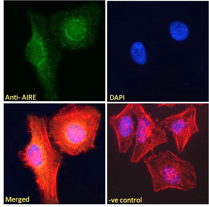 AIRE antibody