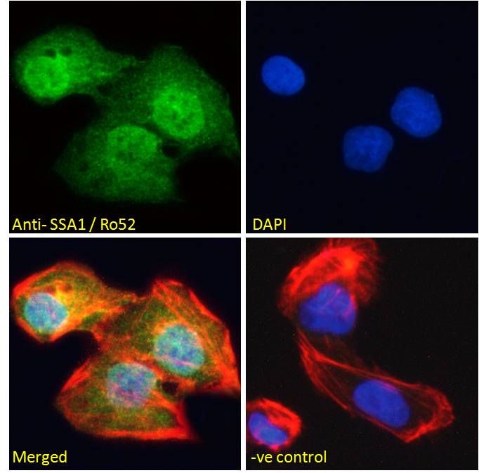 Goat anti-SSA1 / Ro52 Antibody