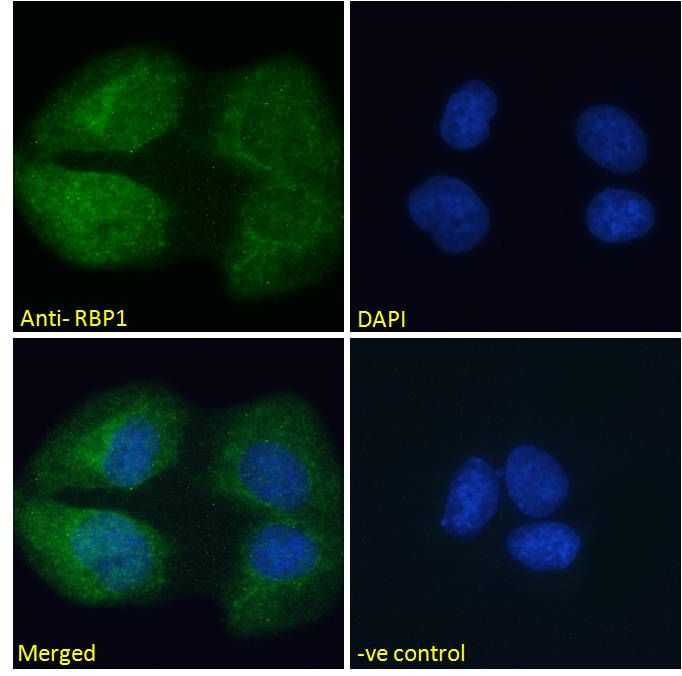 Goat anti-RBP1 Antibody