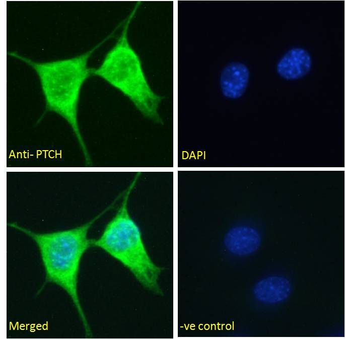 Goat anti-PTCH (C Terminus) Antibody