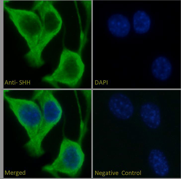 Goat anti-SHH Antibody
