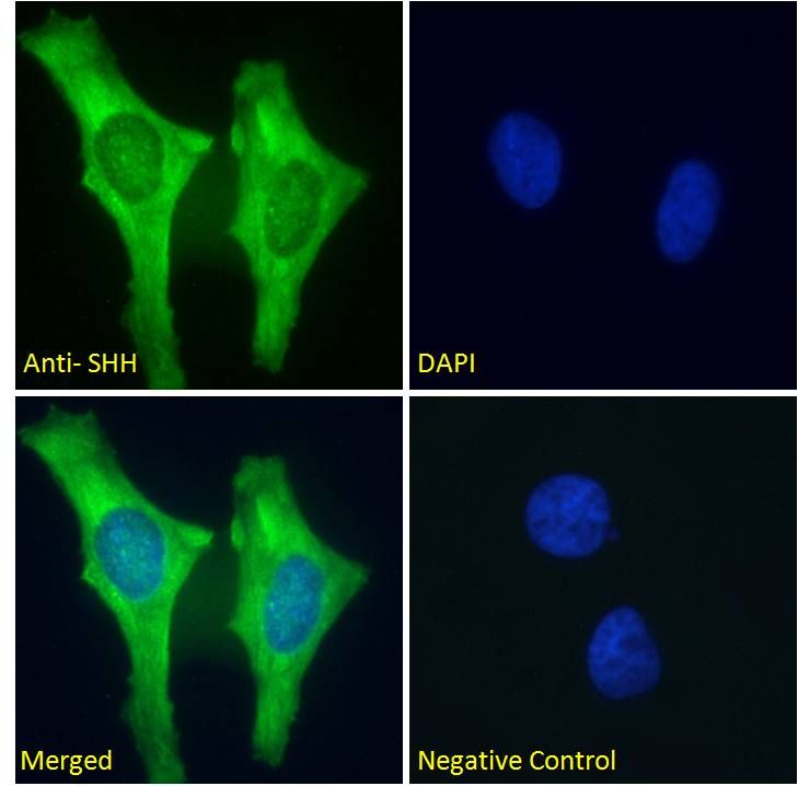 Goat anti-SHH Antibody