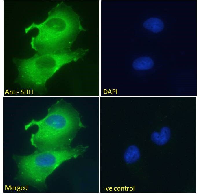 Goat anti-SHH Antibody